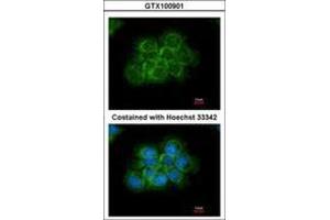 Image no. 3 for anti-V-Crk Sarcoma Virus CT10 Oncogene Homolog (Avian) (CRK) (AA 122-302) antibody (ABIN467422) (Crk 抗体  (AA 122-302))
