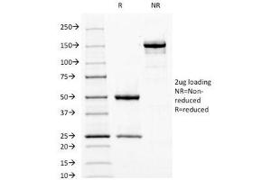SDS-PAGE Analysis of Purified, BSA-Free Fascin Antibody (clone FSCN1/417). (Fascin 抗体)