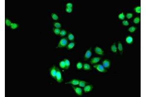 Immunofluorescent analysis of PC-3 cells using ABIN7158230 at dilution of 1:100 and Alexa Fluor 488-congugated AffiniPure Goat Anti-Rabbit IgG(H+L) (DLEU1 抗体  (AA 1-78))