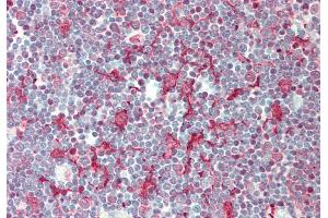 Rabbit Anti-SMPD3 antibody  Formalin Fixed Paraffin Embedded Tissue: Human Thymus Primary antibody Concentration: 1:100 Secondary Antibody: Donkey anti-Rabbit-Cy3 Secondary Antibody Concentration: 1:200 Magnification: 20x Exposure Time: 0. (SMPD3 抗体  (Middle Region))