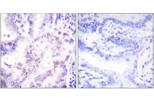 Immunohistochemistry (IHC) image for anti-Thyroid Hormone Receptor, beta (THRB) (AA 11-60) antibody (ABIN1533418)