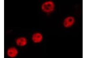 ABIN6275311 staining HepG2 by IF/ICC. (NLE1 抗体  (Internal Region))
