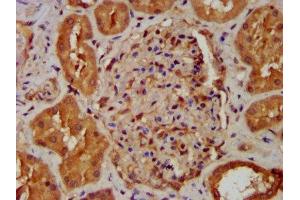 Immunohistochemistry (IHC) image for anti-NADH Dehydrogenase (Ubiquinone) 1 beta Subcomplex, 8, 19kDa (NDUFB8) (AA 29-132) antibody (ABIN7160937)