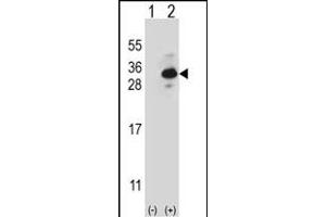 Western blot analysis of CLTB (arrow) using rabbit polyclonal CLTB Antibody (ABIN656850 and ABIN2846055). (CLTB 抗体)