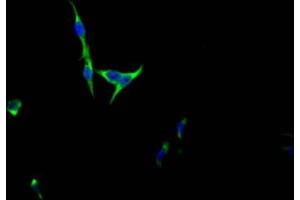 Immunofluorescence staining of HepG2 Cells with ABIN7127489 at 1:50, counter-stained with DAPI. (Recombinant FGFR3 抗体)