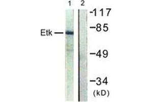 Western Blotting (WB) image for anti-BMX Non-Receptor Tyrosine Kinase (BMX) (AA 6-55) antibody (ABIN2888731) (BMX 抗体  (AA 6-55))