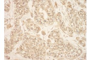 Immunohistochemistry (IHC) image for anti-Ribosomal Protein S6 Kinase, 90kDa, Polypeptide 3 (RPS6KA3) (AA 1-50) antibody (ABIN7454552)