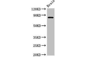 Western Blot Positive WB detected in: Rat brain tissue All lanes: Loxl4 antibody at 4 μg/mL Secondary Goat polyclonal to rabbit IgG at 1/50000 dilution Predicted band size: 85 kDa Observed band size: 85 kDa (LOXL4 抗体  (AA 26-757))