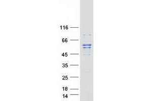 Western Blotting (WB) image for Glycerate Kinase (GLYCTK) (Transcript Variant 1) protein (Myc-DYKDDDDK Tag) (ABIN2722032)
