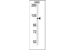 Western Blotting (WB) image for anti-LATS, Large Tumor Suppressor, Homolog 1 (Drosophila) (LATS1) (N-Term) antibody (ABIN359091)