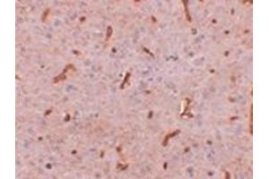 Immunohistochemistry of TWA1 in rat brain tissue with this product at 2. (TTC5 抗体  (C-Term))