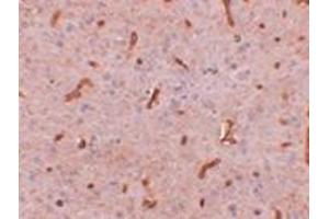 Immunohistochemistry of TWA1 in rat brain tissue with this product at 2.
