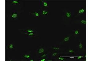 Immunofluorescence of purified MaxPab antibody to SF3B2 on HeLa cell. (SF3B2 抗体  (AA 1-636))