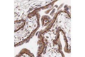 Immunohistochemical staining of human placenta with CXorf15 polyclonal antibody  shows cytoplasmic positivity in trophoblastic cells at 1:1000-1:2500 dilution. (Taxilin gamma (TXLNG) (AA 408-522) 抗体)