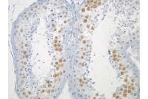 Immunohistochemistry of normal testis (formalin fixed) after antigen retreival, stained with Anti-Mad2L1 (clone 17D10)). (MAD2L1 抗体)