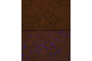 Immunofluorescence analysis of rat brain cells using Talin 2 Rabbit mAb (ABIN7270720) at dilution of 1:100 (40x lens).
