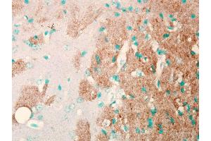 Immunohistochemistry (IHC) image for anti-Sodium Channel, Voltage-Gated, Type IX, alpha Subunit (SCN9A) (AA 1751-1946) antibody (PerCP) (ABIN2483101)