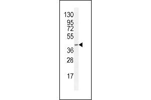 F8A2 Antibody (N-term) (ABIN655340 and ABIN2844904) western blot analysis in CEM cell line lysates (35 μg/lane). (F8A2 抗体  (N-Term))