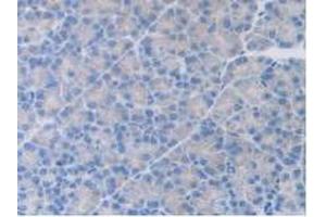 IHC-P analysis of Rat Pancreas Tissue, with DAB staining. (HGF 抗体  (AA 306-471))