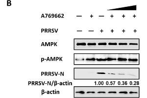 Western Blotting (WB) image for anti-Protein Kinase, AMP-Activated, alpha 1 Catalytic Subunit (PRKAA1) (AA 1-300) antibody (ABIN3021788)