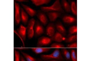 Immunofluorescence analysis of U2OS cells using PSMA5 Polyclonal Antibody (PSMA5 抗体)