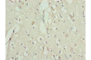 Immunohistochemistry of paraffin-embedded human brain tissue using ABIN7151242 at dilution of 1:100 (TRIM13 抗体  (AA 40-310))