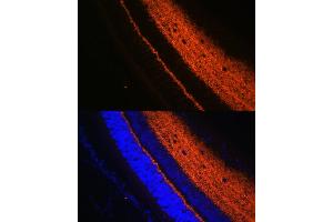 Immunofluorescence (IF) image for anti-Synaptotagmin I (SYT1) (AA 1-422) antibody (ABIN3021250)