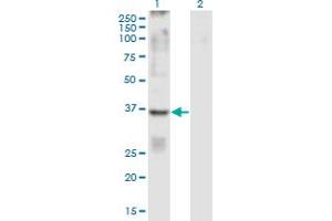 Western Blot analysis of GPR84 expression in transfected 293T cell line by GPR84 monoclonal antibody (M01), clone 5C3. (GPR84 抗体  (AA 208-316))