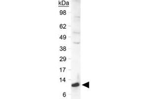Western blot analysis of SLIRP in a human liver lysate using SLIRP polyclonal antibody  at 0. (SLIRP 抗体  (C-Term))