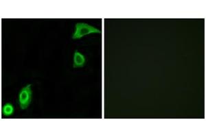 Immunofluorescence analysis of A549 cells, using RPS20 antibody. (RPS20 抗体  (Internal Region))