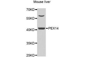 Western blot analysis of extracts of mouse liver, using PEX14 antibody. (PEX14 抗体  (AA 118-377))