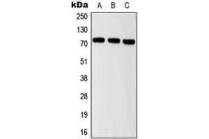 Western blot analysis of ITIH2 expression in MCF7 (A), mouse brain (B), rat brain (C) whole cell lysates. (ITIH2 抗体  (Center))