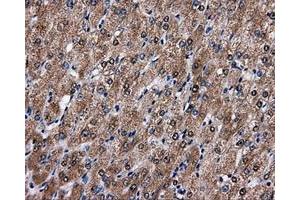 Immunohistochemical staining of paraffin-embedded liver tissue using anti-FAHD2Amouse monoclonal antibody. (FAHD2A 抗体)