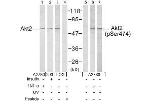 Image no. 2 for anti-V-Akt Murine Thymoma Viral Oncogene Homolog 2 (AKT2) (Ser474) antibody (ABIN197358) (AKT2 抗体  (Ser474))