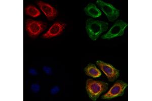 ABIN6260452 and ABIN6278012 staining Hela cells by IF/ICC.