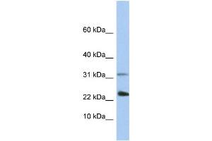 WB Suggested Anti-EXOSC3 Antibody Titration:  0. (EXOSC3 抗体  (C-Term))