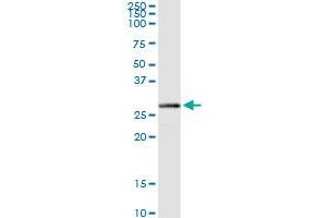 HIBADH MaxPab rabbit polyclonal antibody. (HIBADH 抗体  (AA 1-336))