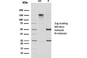 SDS-PAGE Analysis Purified Cytokeratin 14 Mouse Monoclonal Antibody (KRT14/2375). (KRT14 抗体  (AA 351-472))