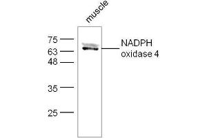 Mouse muscle lysates probed with Rabbit Anti-NADPH oxidase 4 Polyclonal Antibody, Unconjugated  at 1:500 for 90 min at 37˚C. (NADPH Oxidase 4 抗体  (AA 81-180))