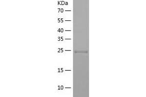 Western Blotting (WB) image for Syntaxin 12 (STX12) (AA 1-248) protein (His tag) (ABIN7125289) (Syntaxin 12 Protein (STX12) (AA 1-248) (His tag))