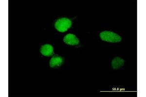 Immunofluorescence of purified MaxPab antibody to ZBTB8 on HeLa cell.