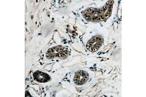 Immunohistochemical analysis of Beta-tubulin staining in human colon formalin fixed paraffin embedded tissue section. (TUBB 抗体)