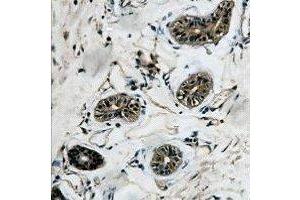 Immunohistochemical analysis of Beta-tubulin staining in human colon formalin fixed paraffin embedded tissue section.