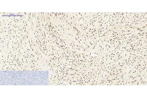 Immunohistochemistry of paraffin-embedded Human uterus tissue using PPARD Monoclonal Antibody at dilution of 1:200. (PPARD 抗体)