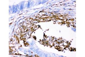 IHC analysis of CD18/ITGB2 using anti-CD18/ITGB2 antibody (ABIN3043260). (Integrin beta 2 抗体  (AA 404-769))