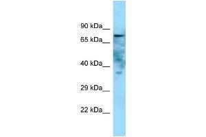 WB Suggested Anti-Golim4 Antibody   Titration: 1. (Golgi Integral Membrane Protein 4 (GOLIM4) (C-Term) 抗体)