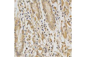 Immunohistochemistry of paraffin-embedded human stomach using DNMT3A antibody at dilution of 1:200 (x400 lens) (DNMT3A 抗体)