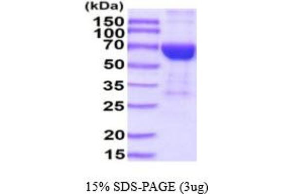 IL17 Receptor B Protein (AA 18-286) (hIgG-His-tag)