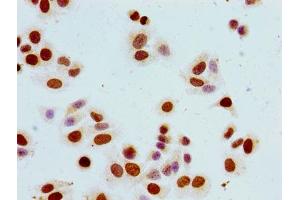 Immunocytochemistry analysis of HepG2 cells using ABIN7139617 at dilution of 1:100 (Histone H1.5 抗体  (pSer17))