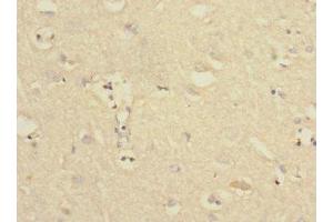 Immunohistochemistry of paraffin-embedded human brain tissue using ABIN7174101 at dilution of 1:100